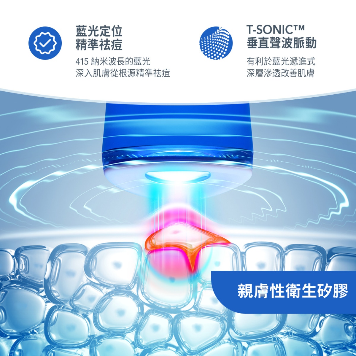 FOREO 至臻煥膚節日套裝 - 艾絲帕達-藍光美顏凈膚儀  F1184