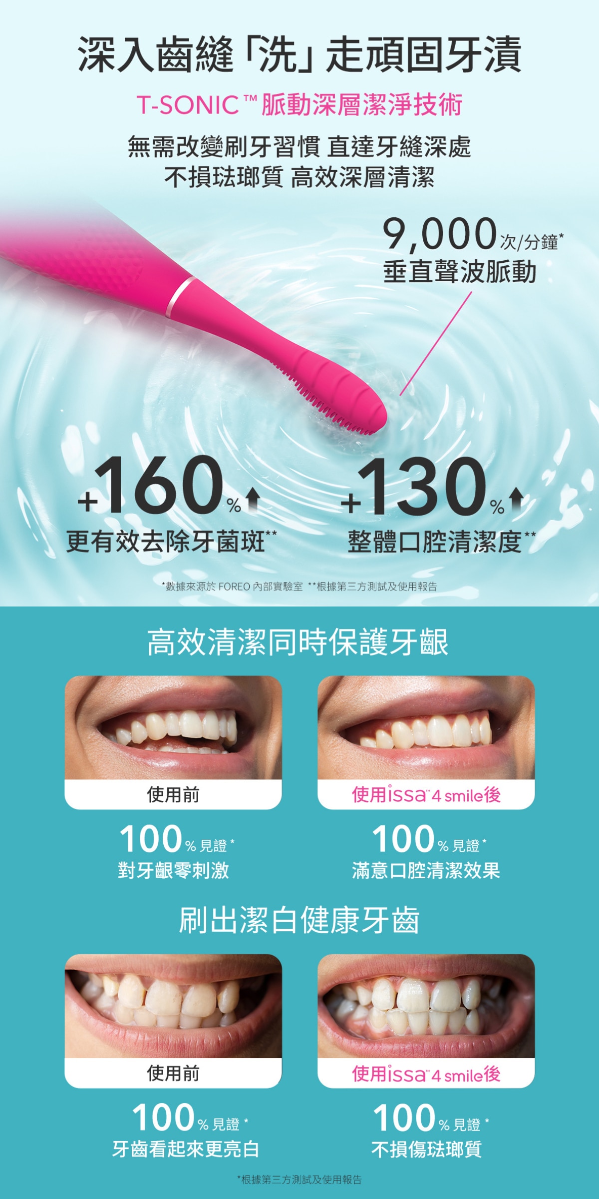 FOREO issa™ 4 smile 智能聲波脈動複合牙刷