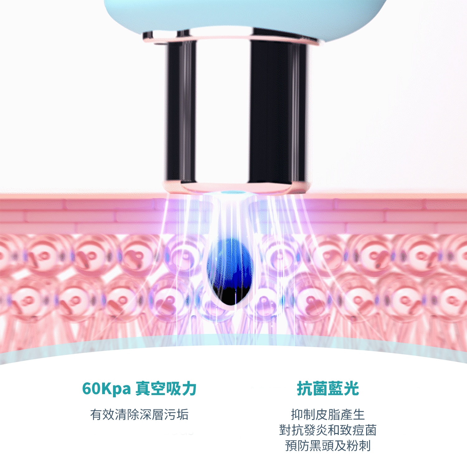 FOREO KIWI™ 藍光去黑頭毛孔吸塵器 F1948