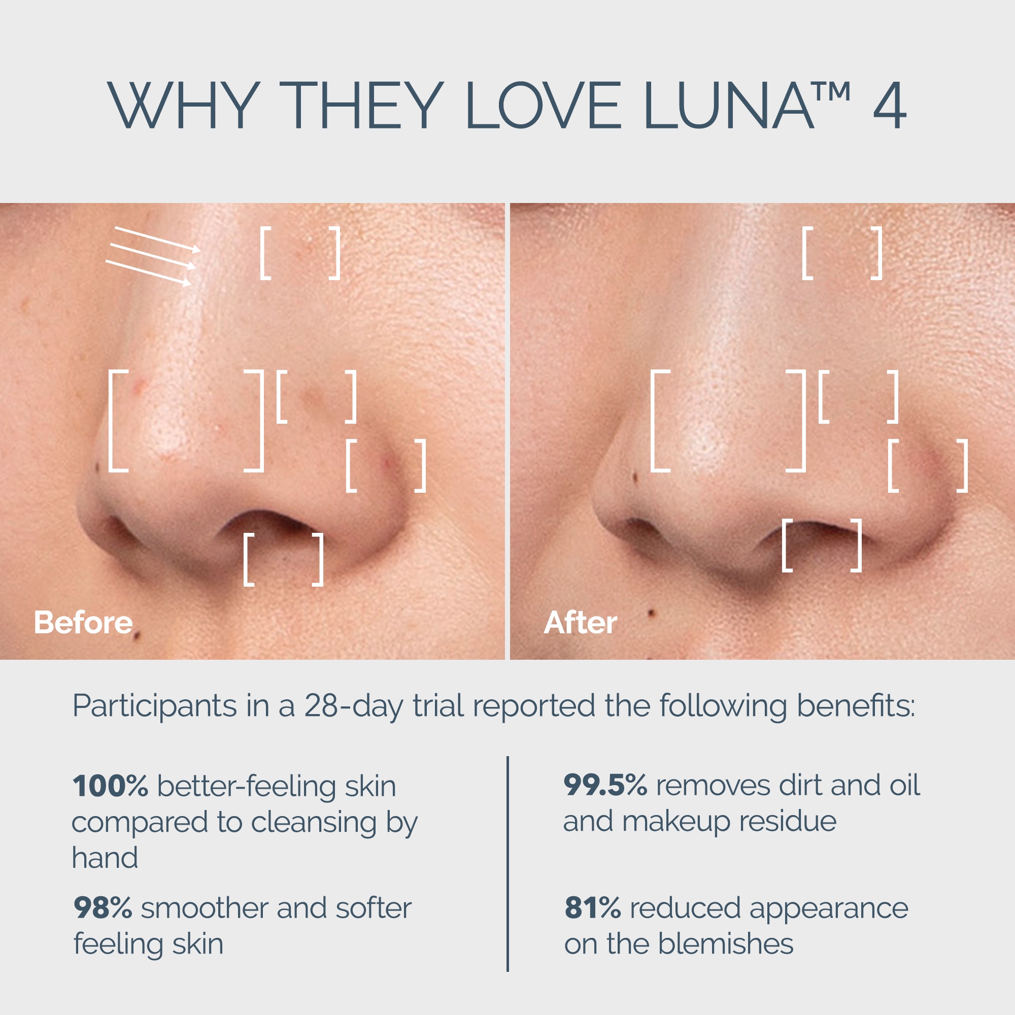 Foreo LUNA 4 Combination Skin