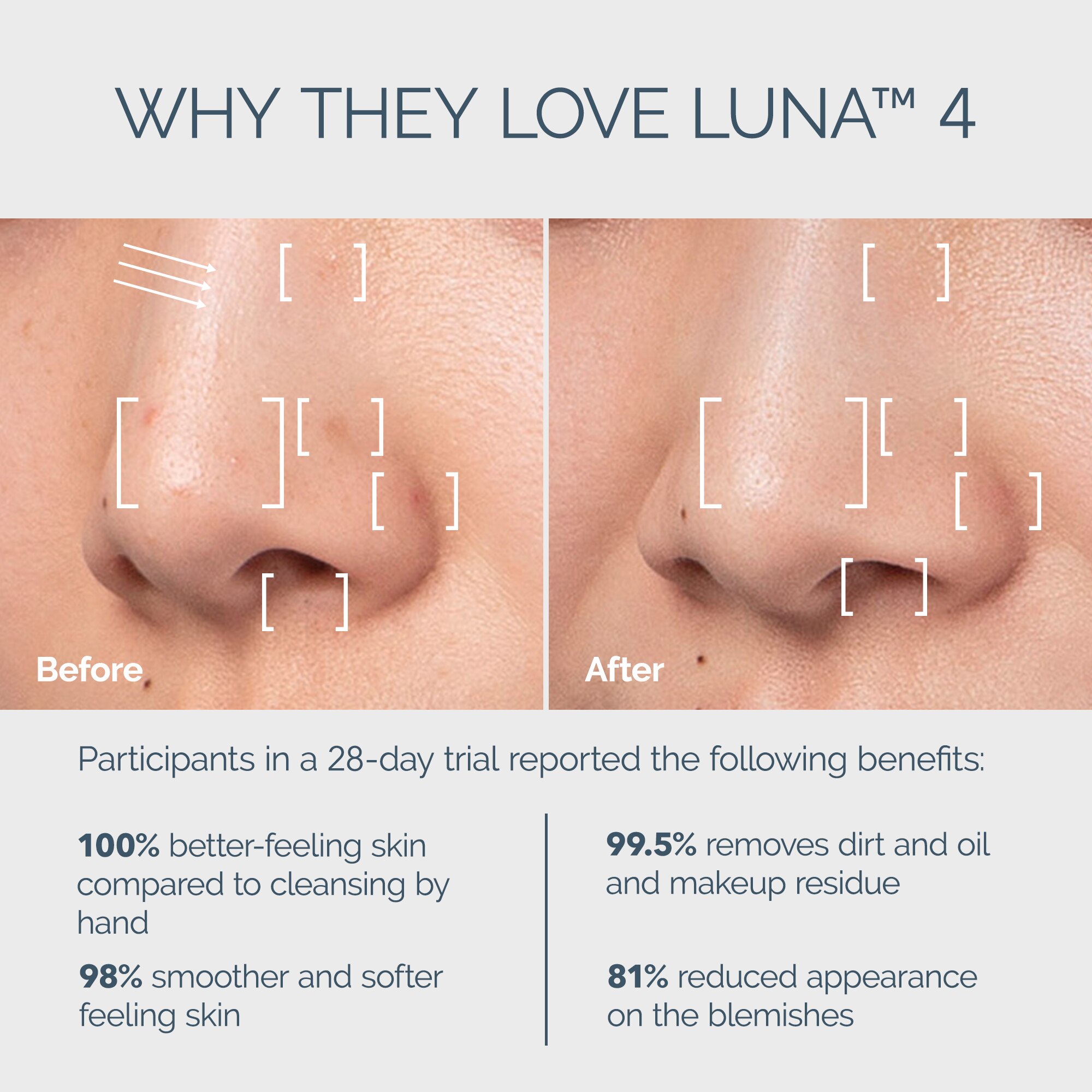 Foreo LUNA 4 Sensitive Skin