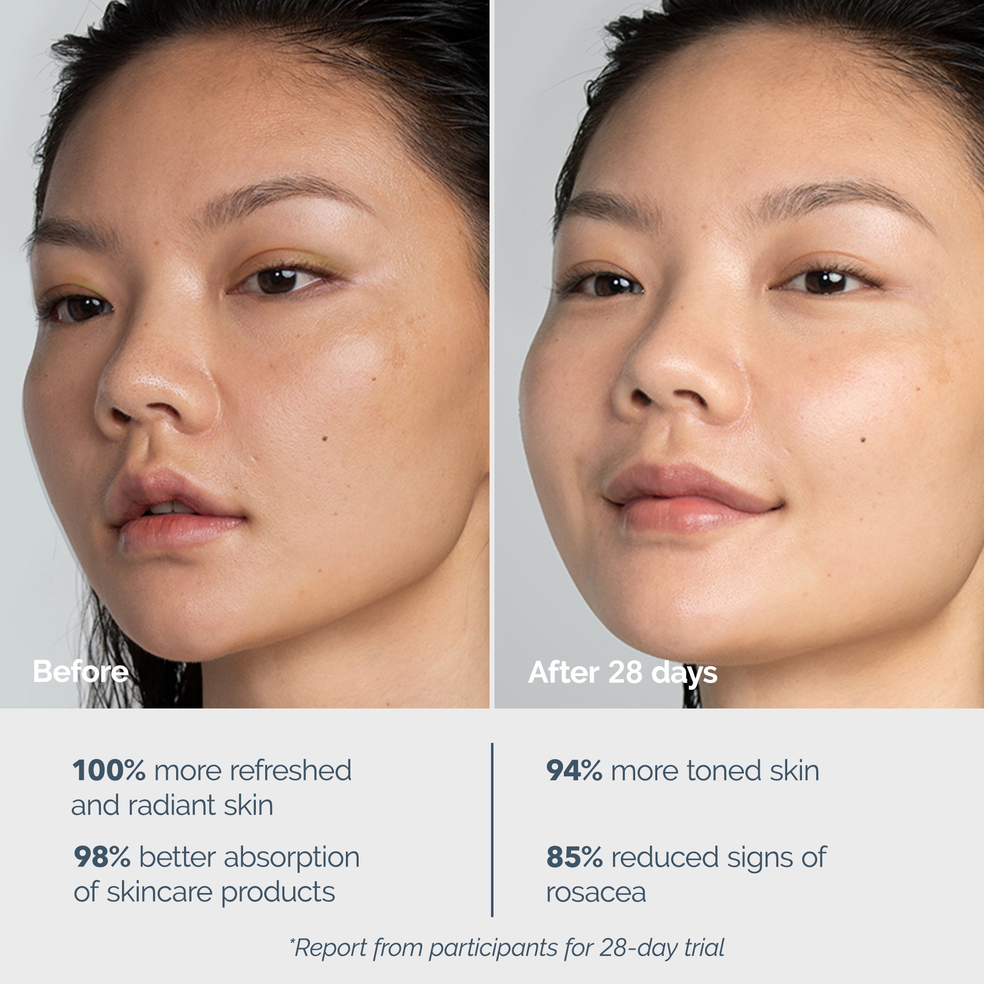 Foreo LUNA 4 Balanced Skin