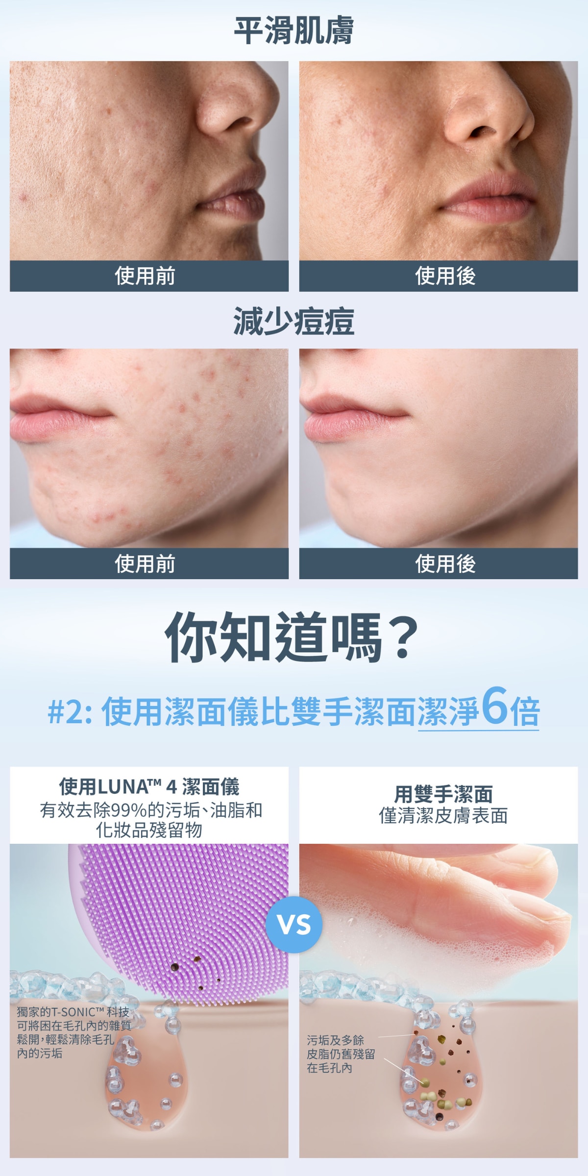 FOREO LUNA 4凈透舒緩潔面儀 (中性肌)