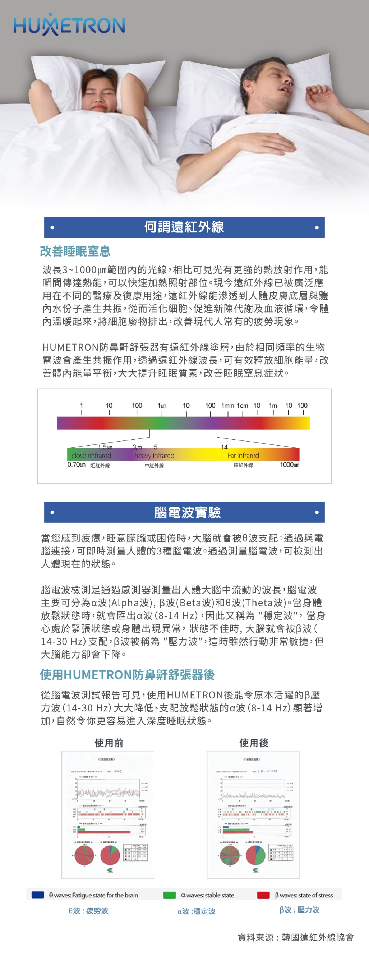 喜眠 止鼻鼾舒張器丨止鼻鼾夾