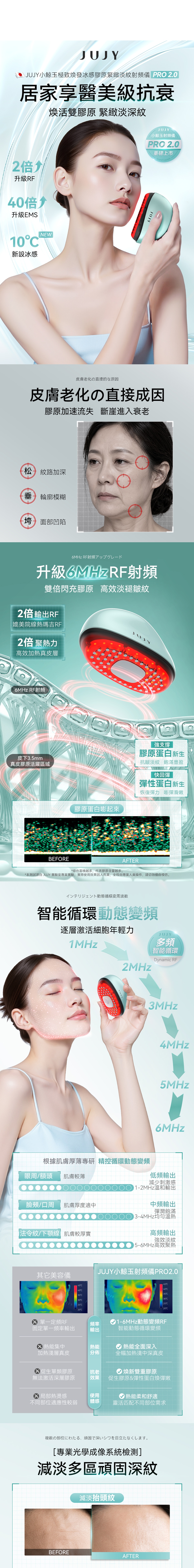 JUJY 小鯨玉極致煥發冰感膠原緊緻淡紋射頻儀 Pro 2.0