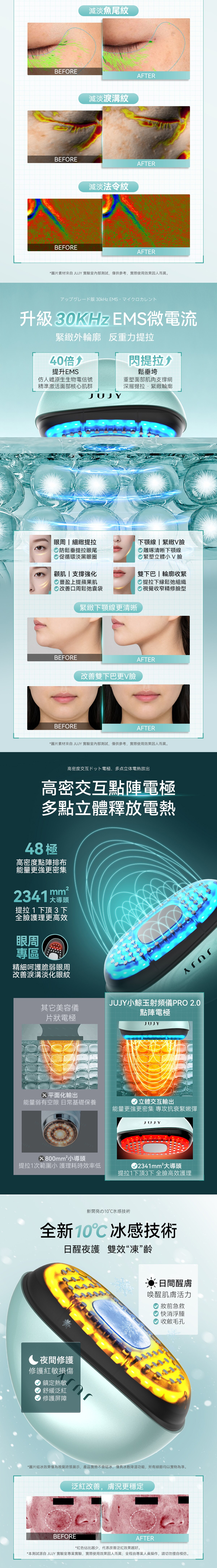 JUJY 小鯨玉極致煥發冰感膠原緊緻淡紋射頻儀 Pro 2.0