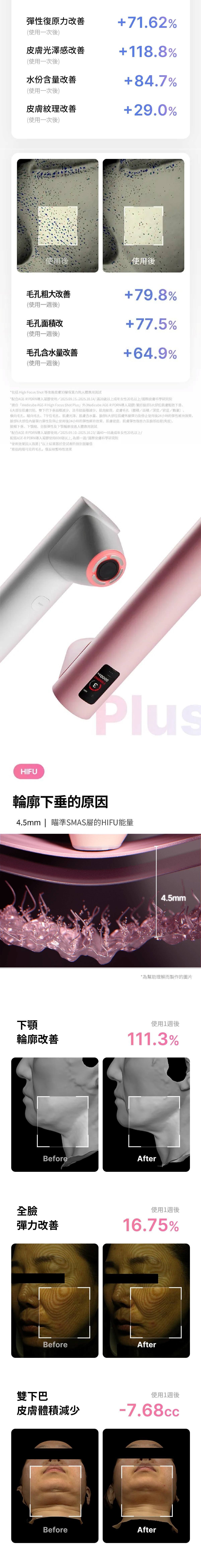 Medicube AGE-R High Focus Shot Plus 超聲波美容儀