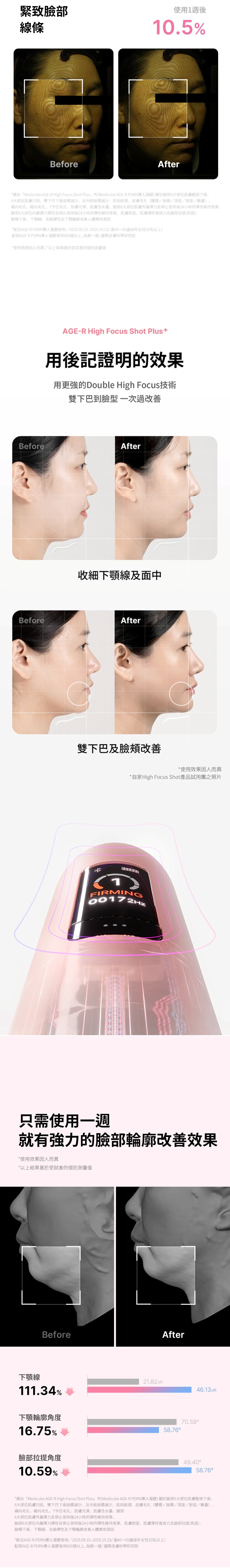 Medicube AGE-R High Focus Shot Plus 超聲波美容儀