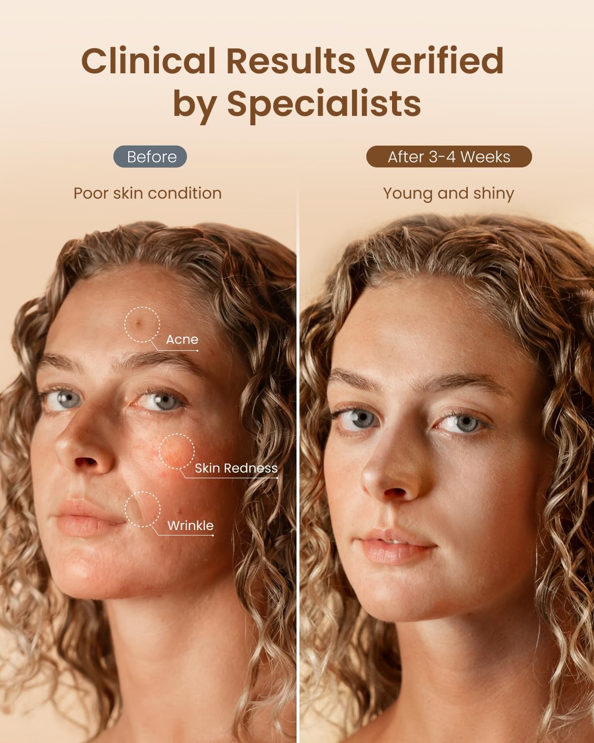 RENPHO REJUVEN ARTEMIS LED光療面膜 E100B