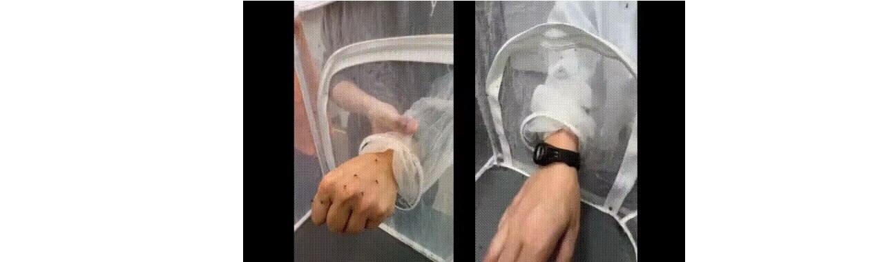 SORBO Mini Ultrasonic Mosquito Repellent (Upgraded Version) - Bracelet