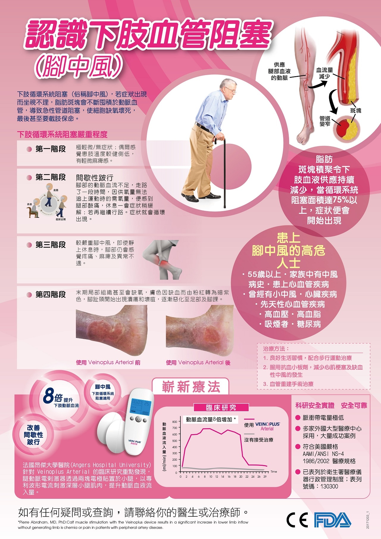 Veinoplus Arterial 電刺激器