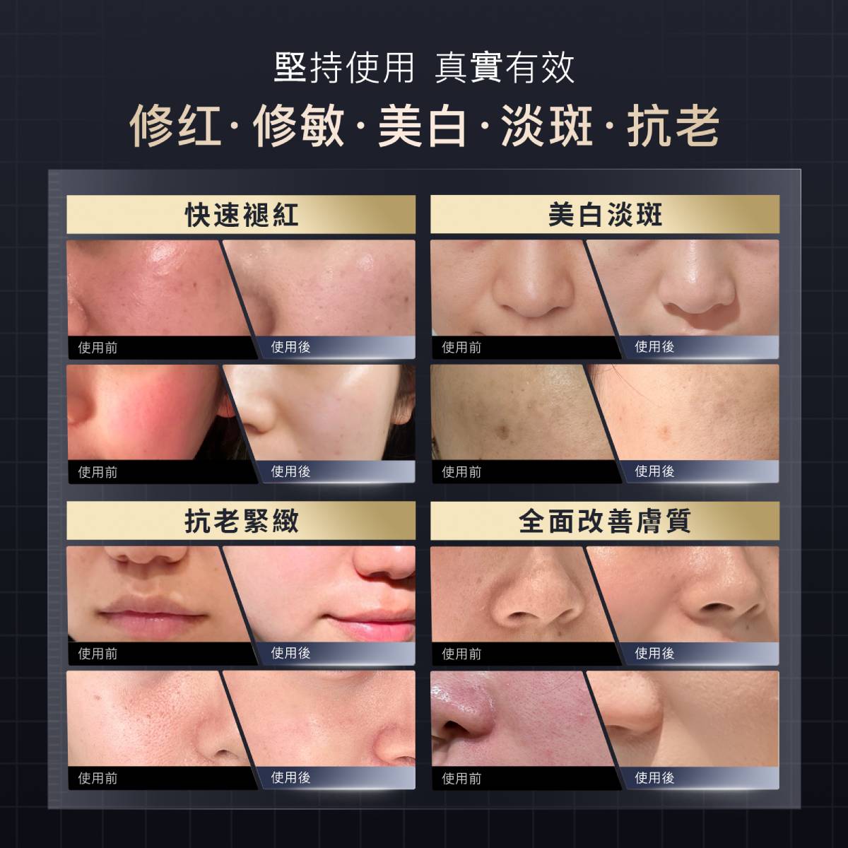 YA-MAN 雅萌 光愈面罩